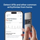 kardiamobile-1-lead-personal-ekg-monitor-4.jpg