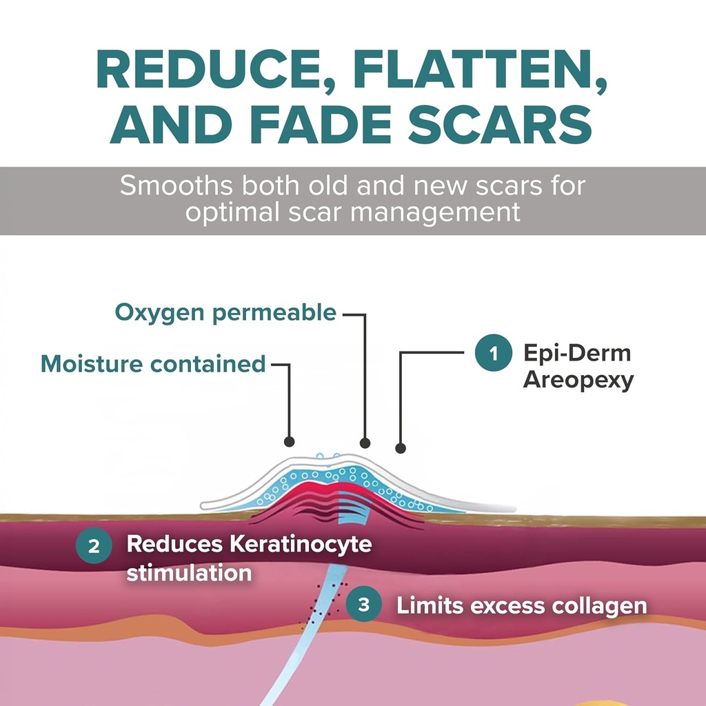 epiderm-areopexy-silicone-scar-sheets-re-4.jpg