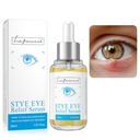 LA.PERSONAL Stye 눈 처리, Chalazion 제거제, Avocado 기름과 더불어 Styes Chalazion와 Blepharitis 처리를 위한 눈 혈청, 바다 buckthorn 기름 & 카페인 1.01 Fl oz/30 Ml