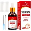 Toe Nail Fungus Treatment for Toenail: 손톱 곰팡이 치료 - 추가 강도, 균열, 손상, 변색 손톱을위한 빠른 인용 솔루션