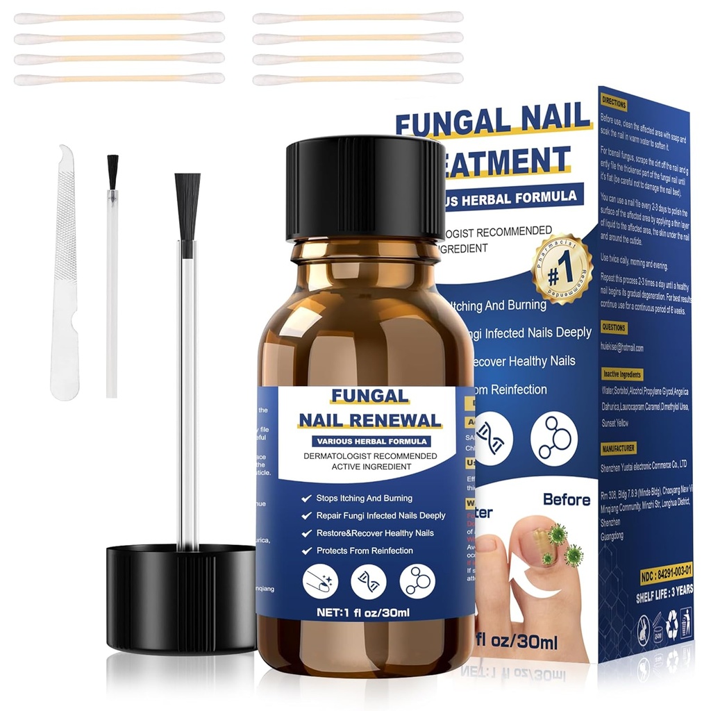 Toenail Fungus 처리,Foot Fungus 처리 여분 힘,Fungus 못 처리, Fungi 못 황색 toenail 처리를 위한 발가락 못 Fungus 처리 (1fl oz/30ml)