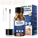 Toenail Fungus 처리,Foot Fungus 처리 여분 힘,Fungus 못 처리, Fungi 못 황색 toenail 처리를 위한 발가락 못 Fungus 처리 (1fl oz/30ml)