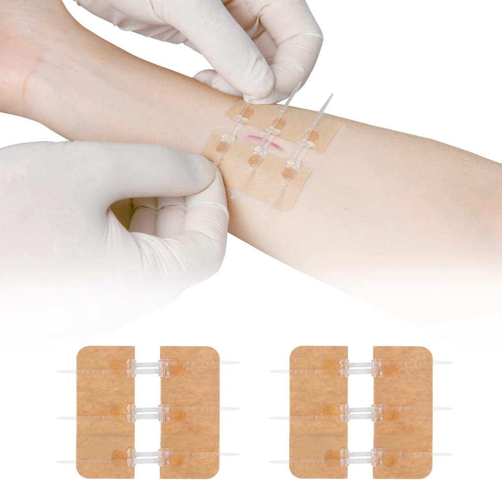 지퍼 스티치 나비 Bandaids 없는 레이스 수리 빠른 구멍 - 비상사태 부상 마감 장치 2 조각 (PU)
