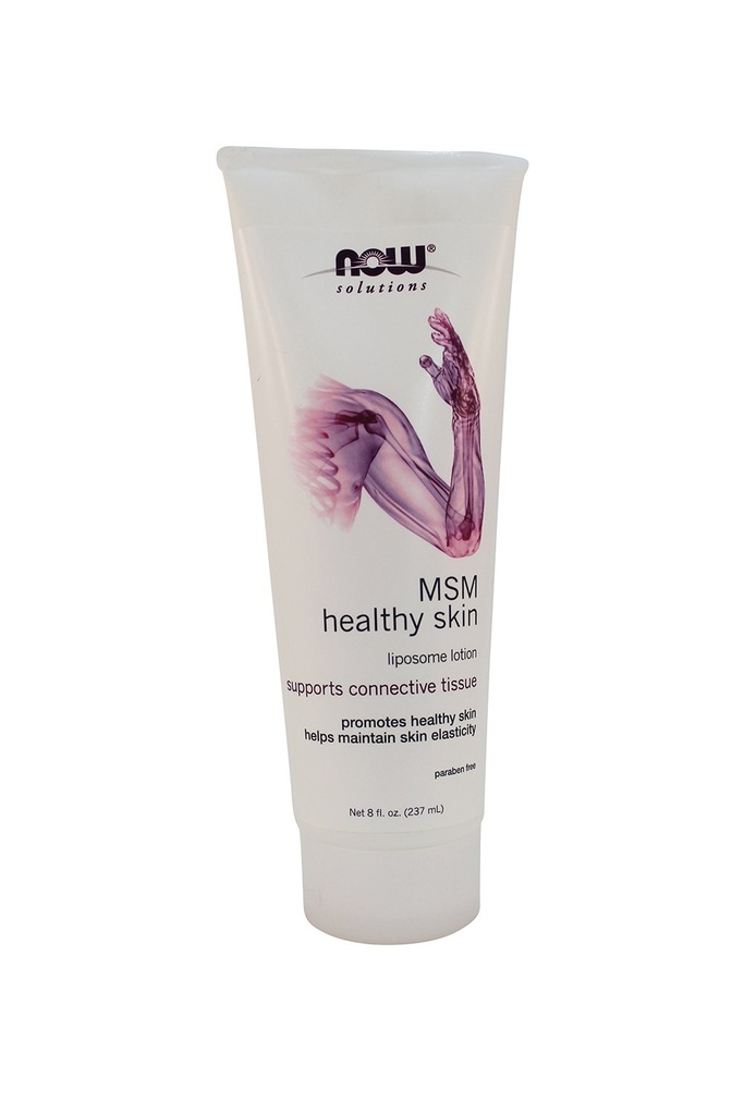 NOW Msm Liposome Lotion, 8 온스 (팩 2)