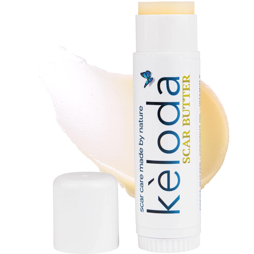 Keloid 흉터 관리 버터 지팡이, 흉터 & Keloids 처리 발, 외과 흉터를 위해 & 칼로이드, 뻗기 표, 여드름, 반대로 Scar 코코아, 칼 버터, 코코넛, & Jojoba 기름에서 칼로이드