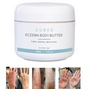 성인을 위한 입방체 4.5 oz Eczema 크림, Eczema 처리, 습기를 공급 건조한 Irridated 피부, 화제 스테로이드 철회 증상을 위한 똑똑한 로션, Psoriasis & Rosacea, Eczema, Dermatitis