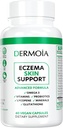 Eczema 보충교재 - 성인을 위한 공식화된 Dyshidrotic Eczema 알약 - Eczema, 과민한 건조한 피부의 개입을 표적으로 하고, Psoriasis 보충교재로 강화해