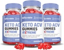 Justified Laboratories (3 팩 MIcrobio Keto ACV Gummies 극단적인 2000MG 마이크로 생물 Keto Gummies 사과 Cider Vinegar는 Pomegranate Beet 주스 분말 B12 Vegan 비 GMO 180 거미로 공식화했습니다
