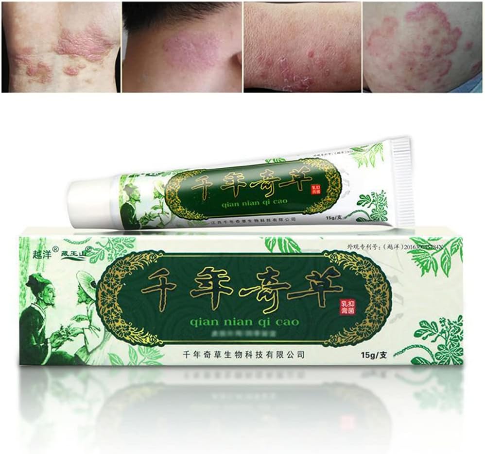 해외 천년 초본 크림 중국 초본 Eczema, Psoriasis 크림 피부염 및 Eczema Pruritus Psoriasis JIULIN 연고