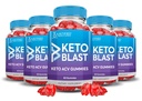 (5 팩) 애플 Cider Vinegar Gummies 1000MG Keto 폭발 Keto ACV Gummies 고급 포름 알레타 주스 분말 B12 Vegan 비 GMO 300 거미