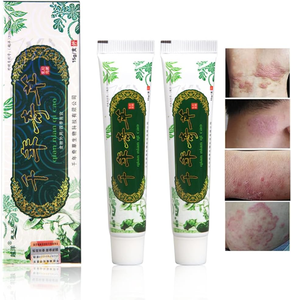 해외 천년 초본 크림 중국 초본 Eczema, Psoriasis 크림 피부염 및 Eczema Pruritus Psoriasis JIULIN 연고 (2PCS)