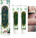 해외 천년 초본 크림 중국 초본 Eczema, Psoriasis 크림 피부염 및 Eczema Pruritus Psoriasis JIULIN 연고 (2PCS)