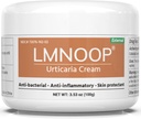 Urticaria 크림, Itching, Redness, Pimples, Rashes, Edema 및 기타 피부 증상을위한 하이브 릴리프 고급 공식