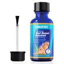 Toenail Fungus 치료 추가 강도 - Toenail에 대한 손톱 곰팡이 치료 - Toe Nail Fungus 치료 추가 강도 - 손톱 곰팡이 치료 (30ml)