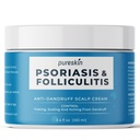 주름을 잡는 피부를 위한 Scalp Soothing 크림, 건조한 빨간 피부, 100ml의 보기의 임시 기복