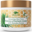 Manuka 꿀 Eczema 크림 습기를 공급 로션 Psoriasis 구호 - Itchy, 드라이 스킨 Rash Ointment - 아기, 어린이, 성인을위한 Soothing Moisturizer - 고강도 바디 & 페이스 크림 4oz