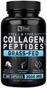 Zeal Naturals Collagen Peptides Collagen Pills (360 캡슐) Grass Fed Collagen Pepetide Powder - JointTendon SupplementHair Skin 및 Nails 용 Hydrolyzed Collagen Powder -