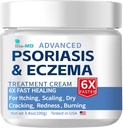 Bio-MD Psoriasis Eczema 크림, 성인을 위한 Eczema 크림, 여분 힘 통제 Reoccurrence, Seborrheic Dermatitis, Folliculitis 처리를 위해, 효과적인 저항하는의 구호