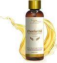 Siya Ayurveda Psoriasis Treatment Oil for Natural Relief | Scalp Psoriasis & Skin Care | 뿌리에서 Psoriasis 제거 | 천연 성분으로 만든 - 100 ml