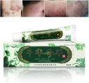 해외 천년 초본 크림 중국 초본 Eczema, Psoriasis 크림 피부염 및 Eczema Pruritus Psoriasis JIULIN 연고