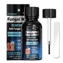 Toenail Fungus 치료, 손톱 곰팡이 치료, 손톱 수리 솔루션, 손상 및 변색 손톱, 손톱 곰팡이 치료, 안전하고 부드럽게 - 30ML (1 FLOZ)