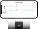 AliveCor KardiaMobile 6-Lead Personal EKG Monitor – 심장의 여섯 가지 보기 – AFib와 Irregular Arrhythmias – 즉시 결과 30 초 – 대부분의 스마트 폰과 작동