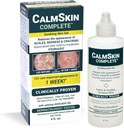Xenna CalmSkin Complete | 임상의 입증된 피부와 피부의 외관을 개선하여 밀드를 모더레이트 Psoriasis | 미국에서 만든 | 4 fl. oz.