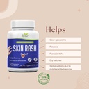 Natural Skin Relief – Soothing Itchy, Dry 및 Irritated Skin의 초본 보충 – 100 % Plant-Based, 채식 캡슐